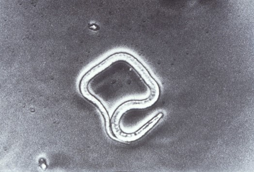 AMicroscopic photograph of filaria nematode 